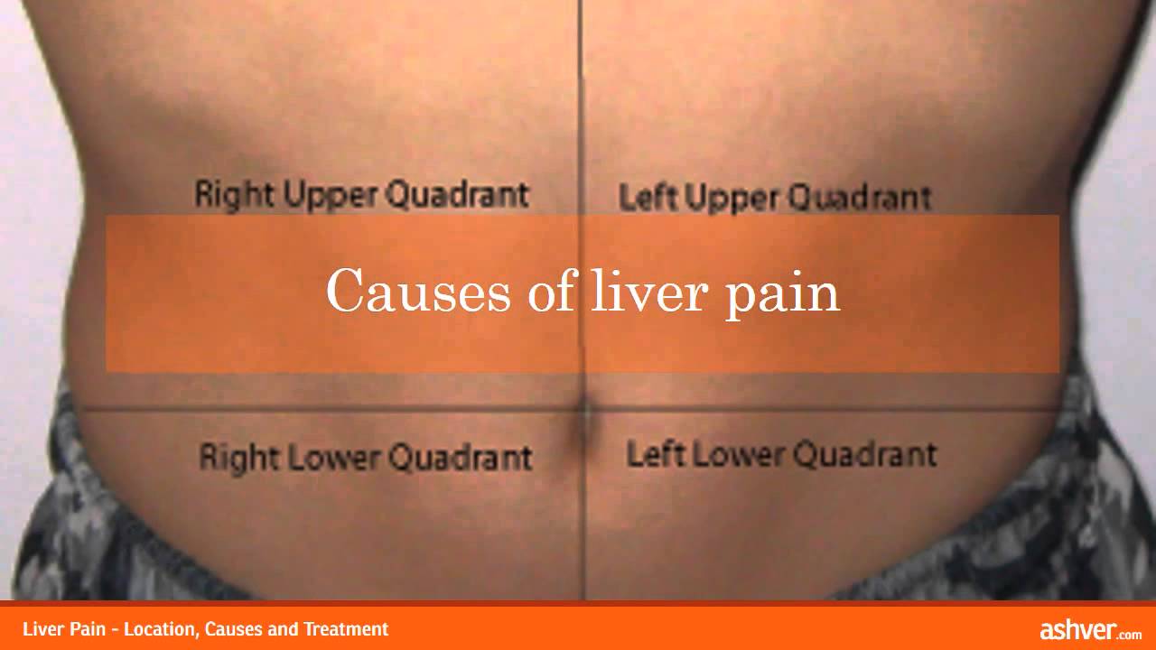 Liver Pain - Location, Causes and Treatment - YouTube