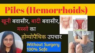 Piles|बवासीर का इलाज | बवासीर की दवा | बवासीर के लक्षण | piles homeopathic medicine | piles ki dawa