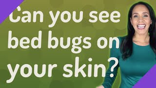 Can you see bed bugs on your skin?