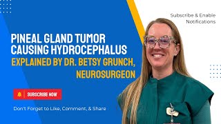 Case study 75 - Pineal gland tumor causing hydrocephalus explained by a neurosurgeon #braintumor