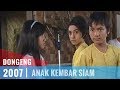 Dongeng - Episode 44 | Anak Kembar Siam