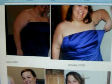After Prednisone Weight Loss