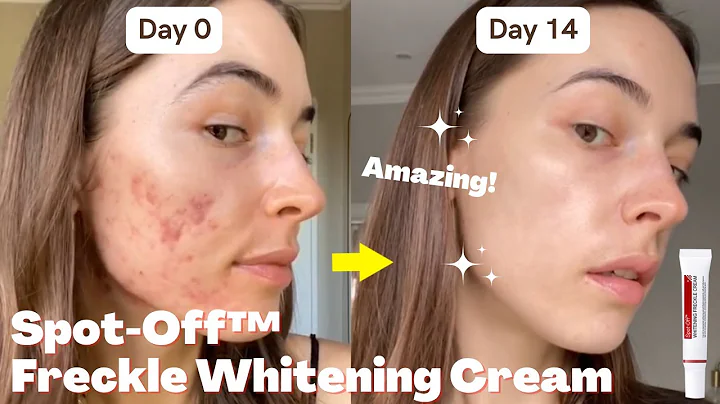 Spot-Off Freckle Whitening & Removal Cream | Dayiala.com - DayDayNews