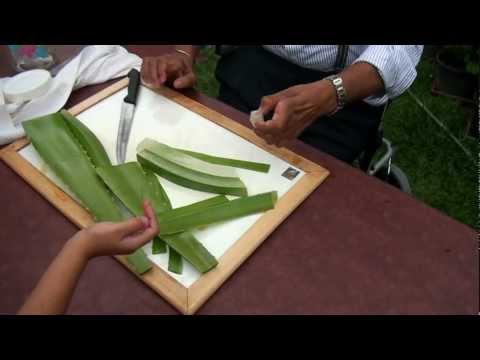 Video: Aloe Vera For Kviser: 7 Måter å Bli Kvitt Kviser