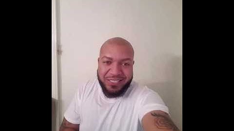 3D Scalp Micropigmentation 1 year later, life w/ confidence FREEDOM