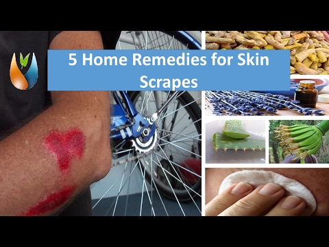 5 Home Remedies for Skin Scrapes