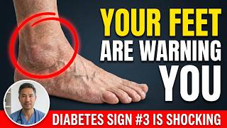 9 Warning Signs in Your Feet That Predict Diabetes Years Early (Don’t Ignore!)
