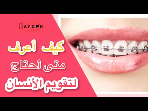فيديو: كيف تعرف متى يتم قطع الأسنان