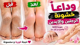 Say Goodbye to Rough Hands and Feet Forever‼️ An Easy Recipe for Soft Skin and Cracked Heels from... screenshot 5