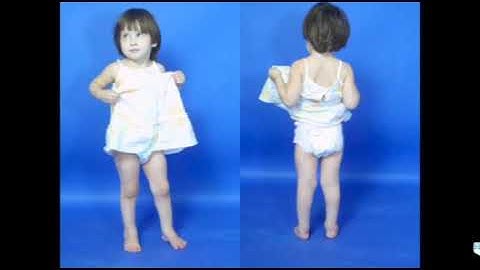 Video 2020  Controversies inPediatric Limb ReconstructionJohn E. Herzenberg, M.D