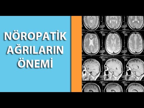 Video: İtlərdə Nöropatik Ağrı