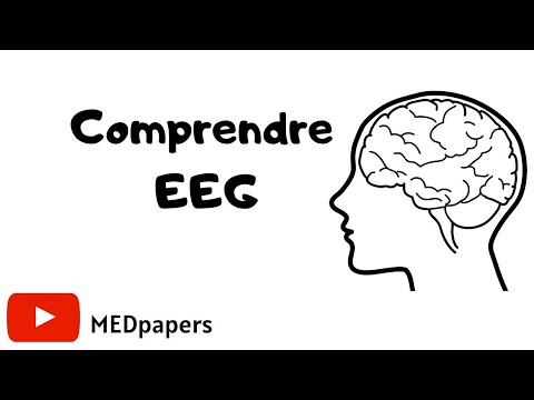 Vidéo: Comparaison De La Mesure EEG Du Mouvement Des Membres Supérieurs Dans Le Système D'entraînement à L'imagerie Motrice