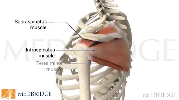 Shoulder Arthroplasty: Return to Function Video - ...