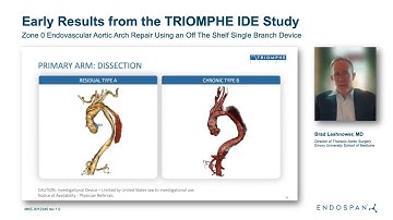 STS 2024 TRIOMPHE Study Early Results