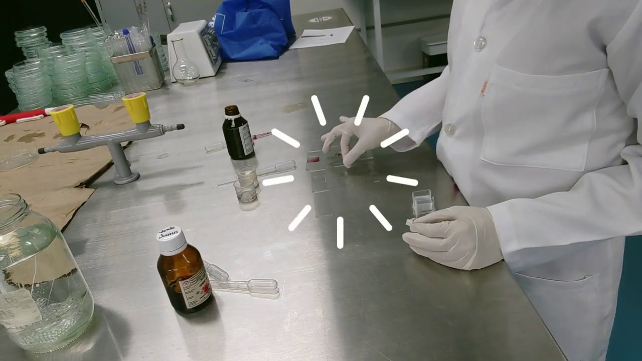 Observación y caracterización de protozoarios