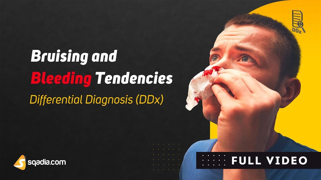 bruising-and-bleeding-tendencies-differential-diagnosis-ddx