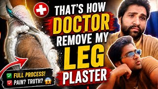 Don't Watch If You're Scared! Leg Plaster Removal 😱 #luckyvlogrevange #hospitallife