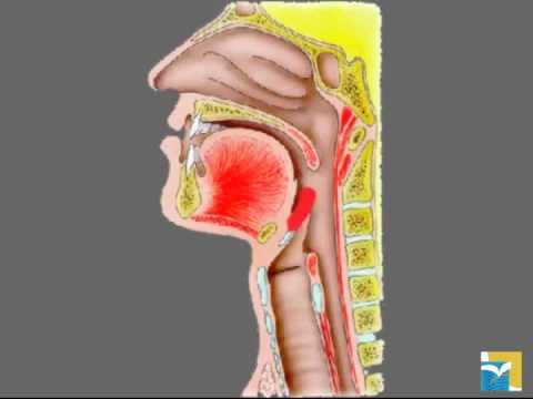 Epiglottite