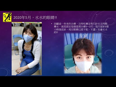 眼睛乾乾澀澀的，除了滴眼藥水 還能怎麼辦?