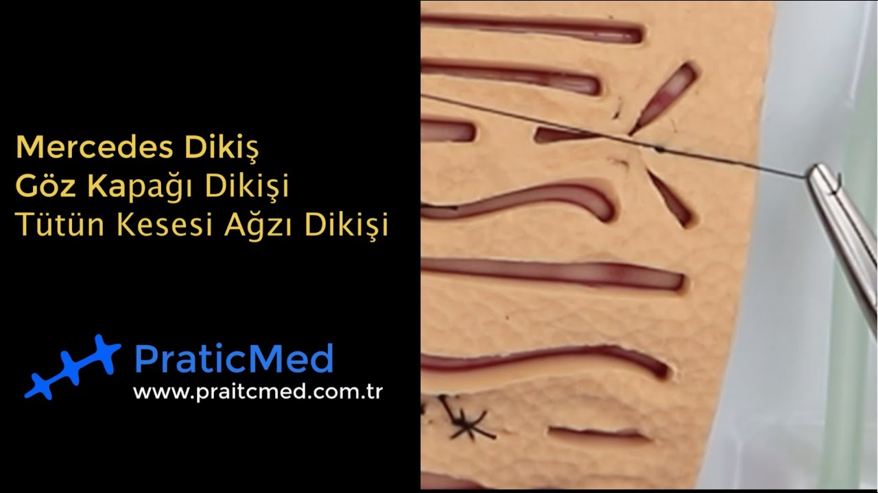 Mercedes Dikişi, Göz Kapağı Dikişi, Tütün Kesesi Ağzı Dikişi I PraticMed® Sütür Eğitim Videoları