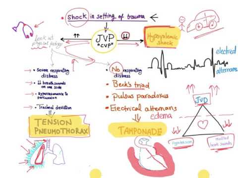 Video: Geslachtsverschillen In Trauma, Shock En Sepsis