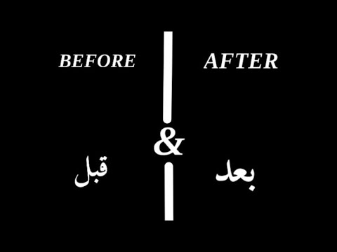 قبل و بعد ممثلين و ممثلات مسلسل سايق الستوته 