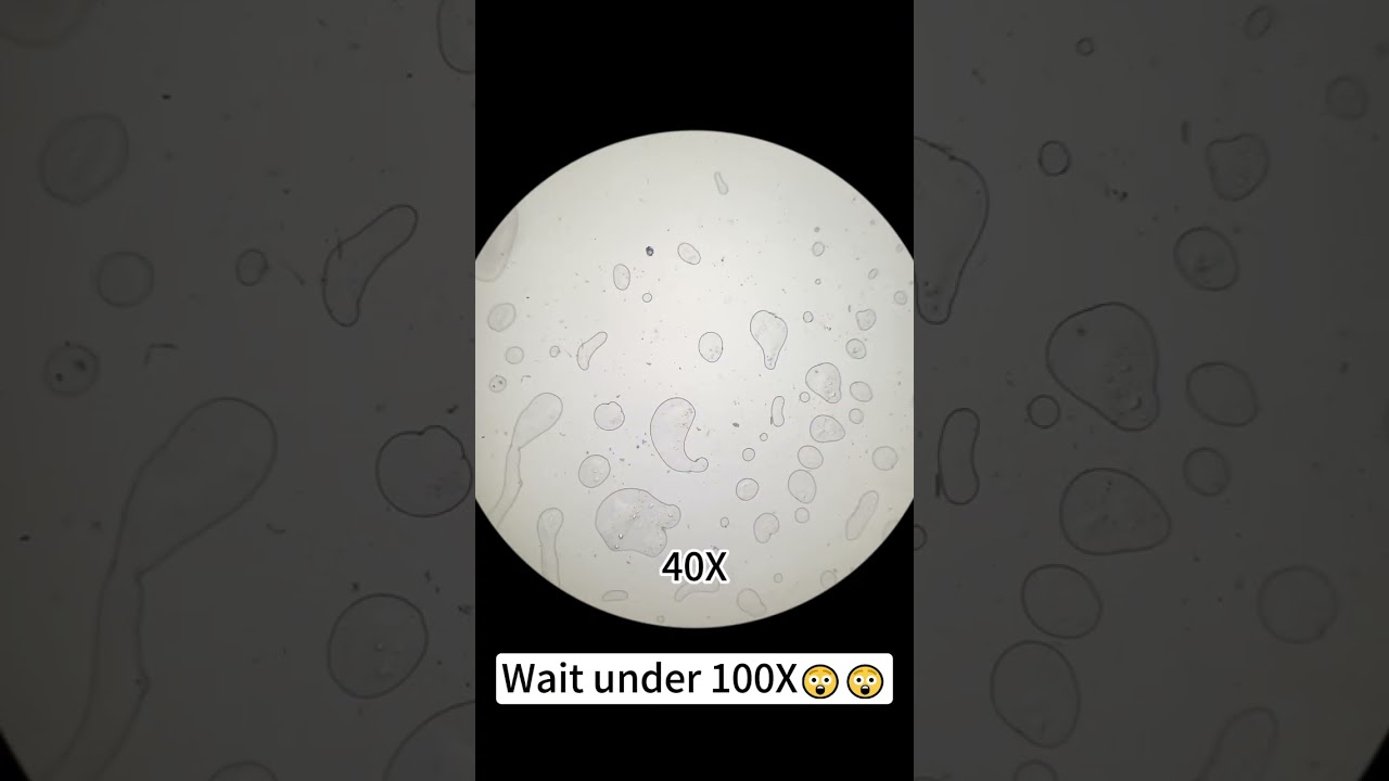 Evian mineral water magnified 400X is seriously awesome!