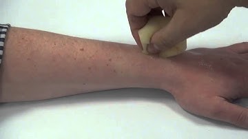 ez wounds - realistic wound simulation for evereyone