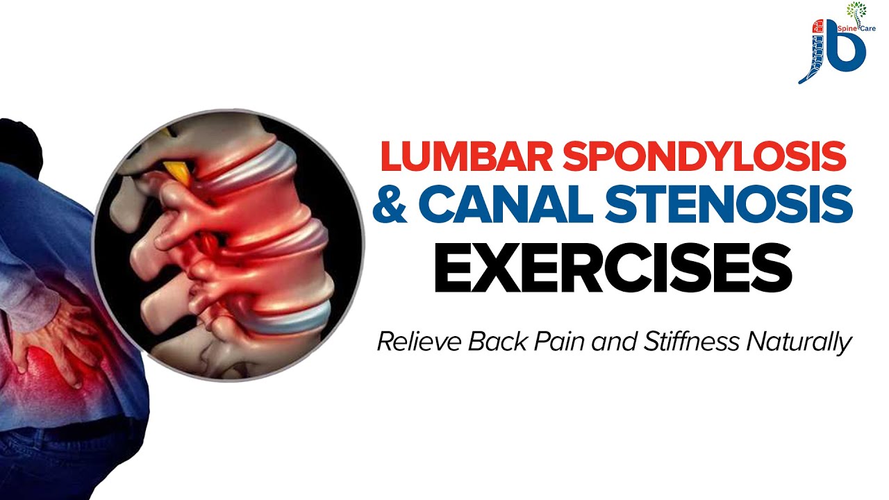 How to Relieve Back Pain from Lumbar Spondylosis & Spinal Stenosis ...