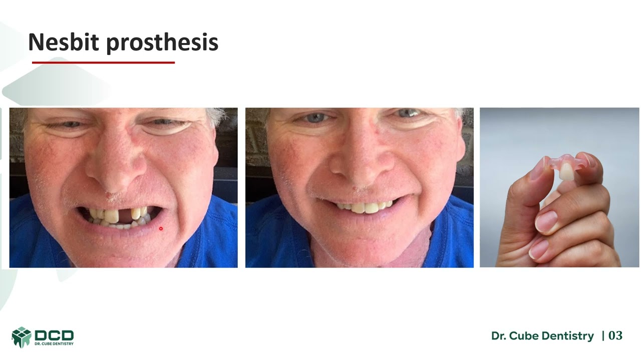Prosthetic 4th Stage Case Sheet شرح الكيس شيت ونصائح مهمة لطلاب طب الاسنان في العيادات