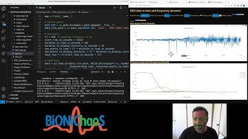 Advanced EEG Data Analysis: Navigating Seizure Events and Interface Optimization