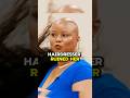 Hairdresser Sued For Burning Woman’s Hair