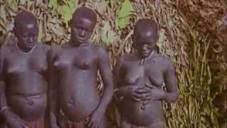 Nude Male midget