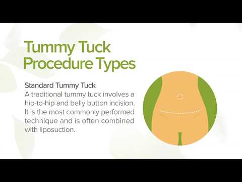tummy-tuck:-benefits,-types-and-recovery-|-marin-aesthetics