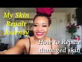 Products for Damaged Skin | Skin Repair Journey Part 1