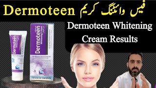 Dermoteen Whitening Cream Review |Hand and Foot Whitening  cream In Pakistan