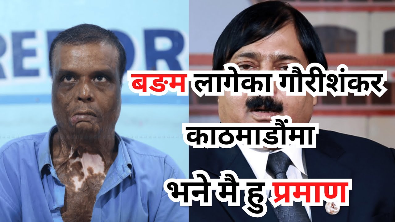 Bom/b Blast Victim Gaurishankar Ram Chamar Speaks Out After Aftab Alam's Acquittal | Aftab Alam Case