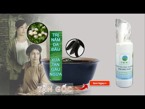 trị nấm da đầu bằng thảo dược[http://cachtrinamdadau.com/]