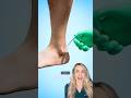 The TERRIBLE parasite you’ve never heard of! (@zackdfilms)