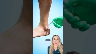 The TERRIBLE parasite you’ve never heard of! (@zackdfilms)