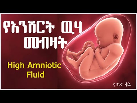 ቪዲዮ: የሸርት ድንጋይ ምንድነው?