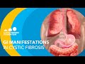 NACFC 2020: GI Manifestations in Cystic Fibrosis