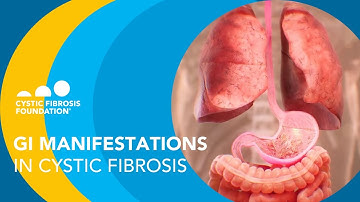 NACFC 2020: GI Manifestations in Cystic Fibrosis