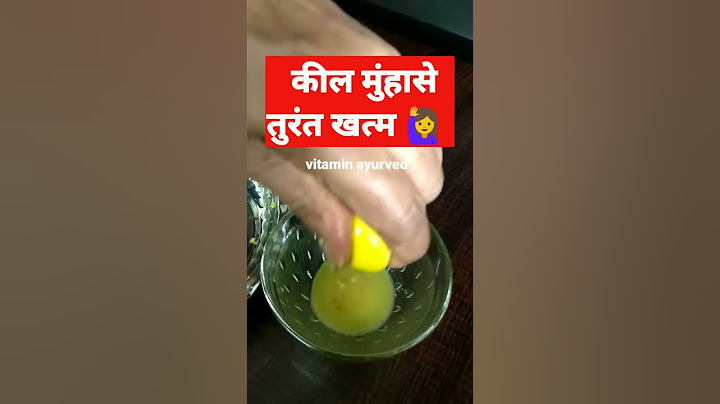 Acne/Pimples, कील/मुंहासे का रामबाण इलाज। #shorts