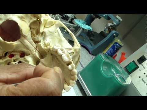 Video: Gdje je veći nepčani foramen?