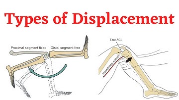 Biomechanics. Kinematic Variables (Part 1).  Types of Displacement/motion.