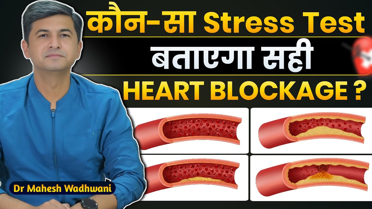 Heart Disease सही समय पर Detect करने का सही Stress Test कौन-सा है? l Stress Test for Heart Blockage