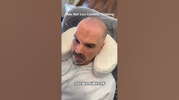 Session 1 Results shown #smp #scalpmicropigmentation #smptraining #edmonton