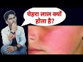 चेहरे पर Redness क्यों आती है🔥 | Reason Behind Redness On Face | Usefullproducts