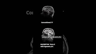 Image quality in 7T #MRI | #siemenshealthineers #radiology